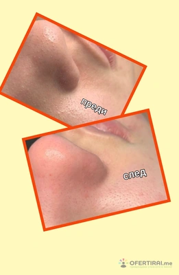 Изображение на доставчика