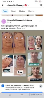 Лечебен масаж или Лифтинг масаж на Лице - Image 4