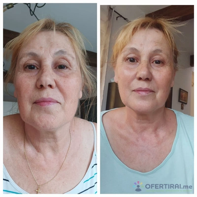 Лечебен масаж или Лифтинг масаж на Лице - Image 3