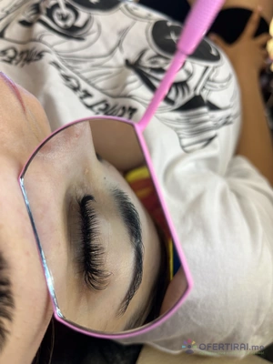 Миглопластика 🎀