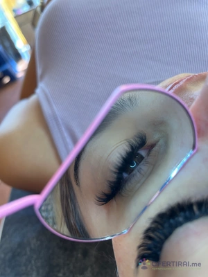 Миглопластика 🎀