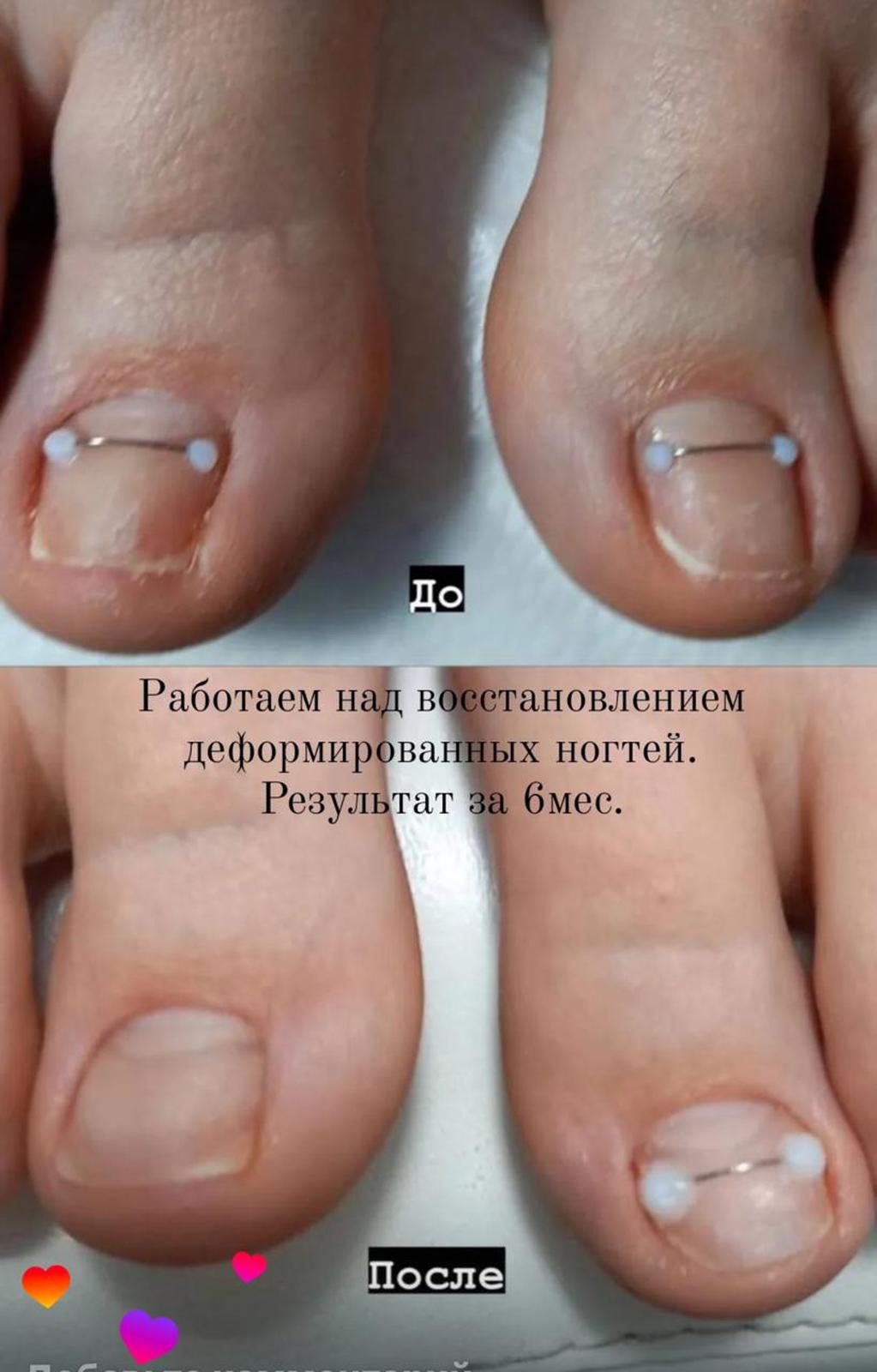 Главно изображение на портфолио