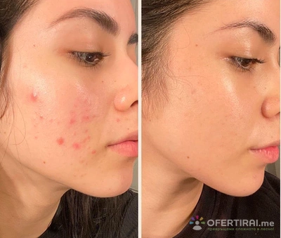 Изображение на специалиста