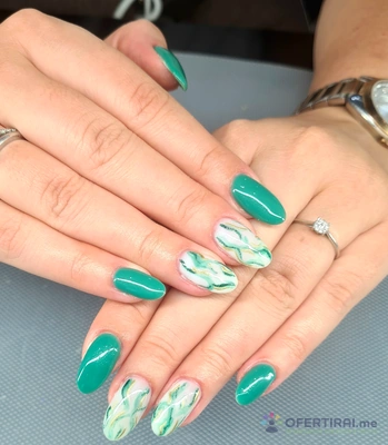 Ноктопластика  - Image 2