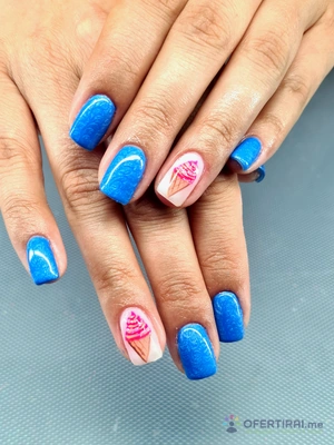 Ноктопластика  - Image 5