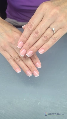 Ноктопластика  - Image 3