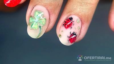 Ноктопластика  - Image 4