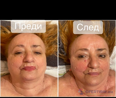 Изображение на доставчика